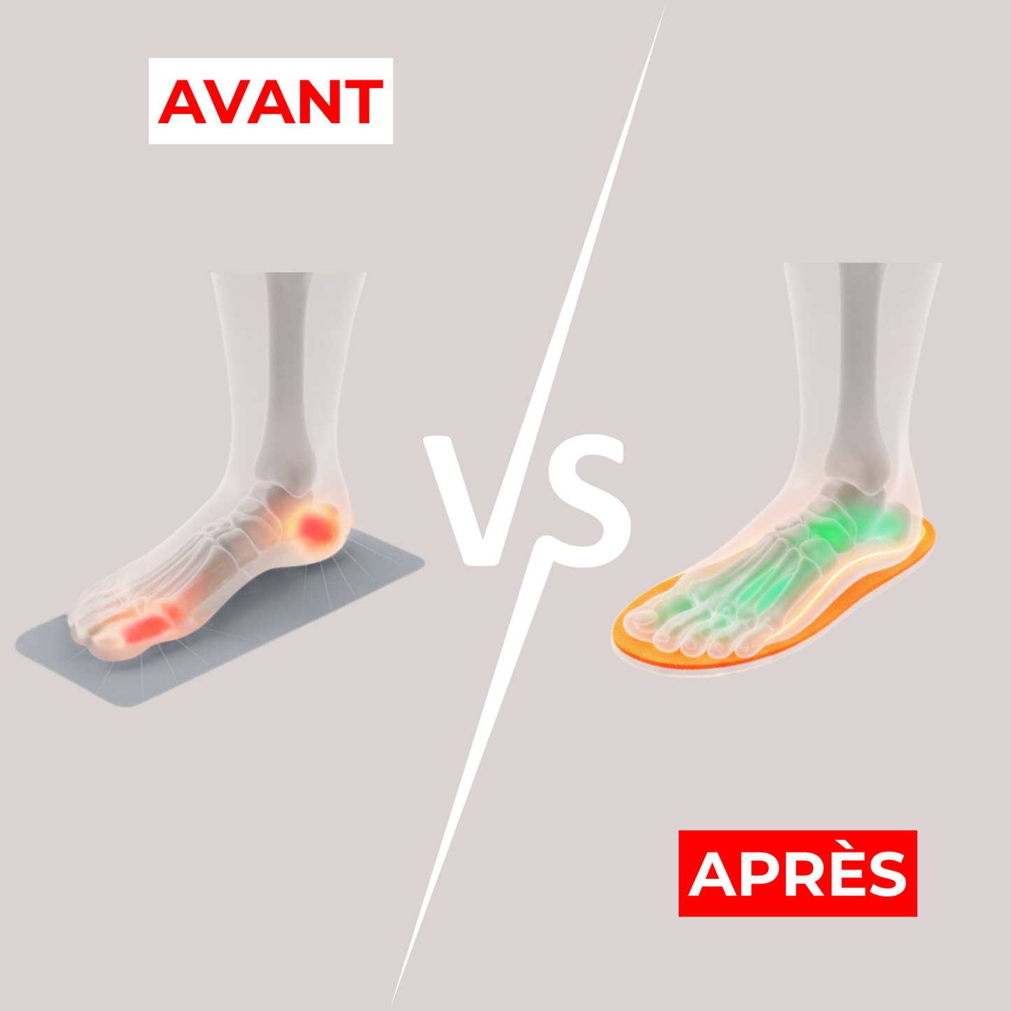 Semelles 4D orthopédiques